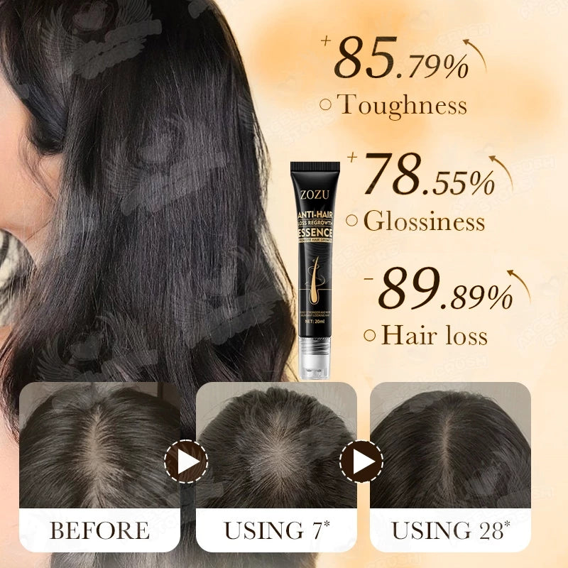 Zozu Anti hair loss regrowth essence
