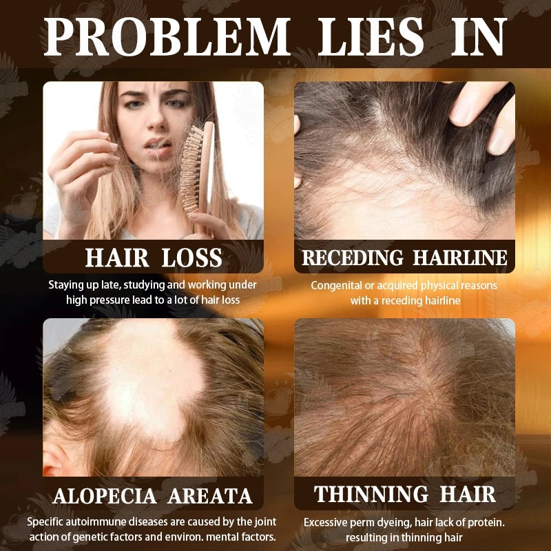 Zozu Anti hair loss regrowth essence