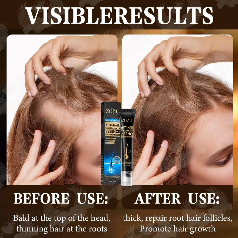 Zozu Anti hair loss regrowth essence