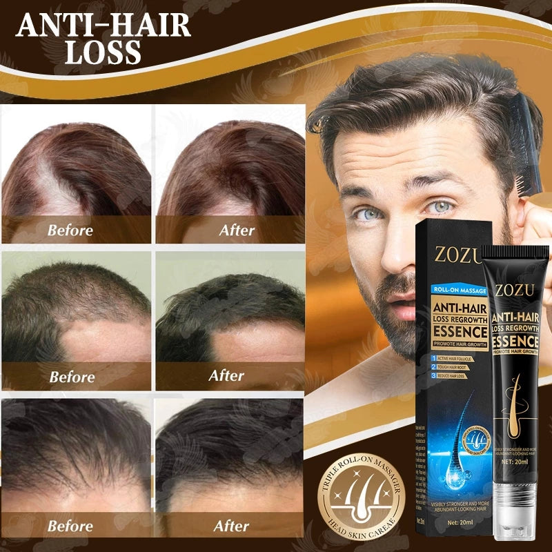 Zozu Anti hair loss regrowth essence