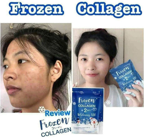 ❄️ Frozen Collagen 2 in 1 Whitening X10 – Daily Glow Formula (60 Capsules)authentic 100 💯