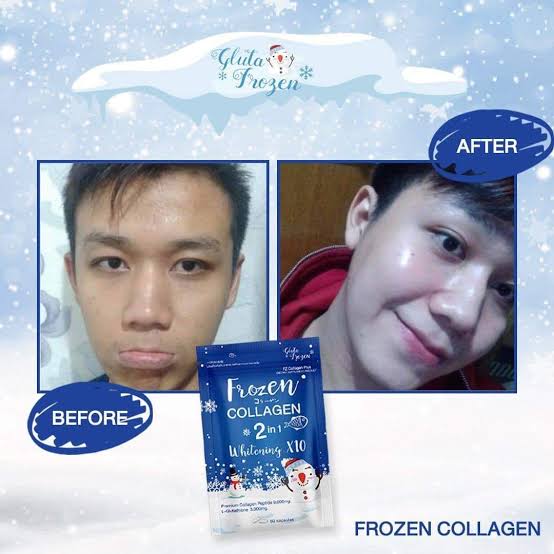 ❄️ Frozen Collagen 2 in 1 Whitening X10 – Daily Glow Formula (60 Capsules)authentic 100 💯