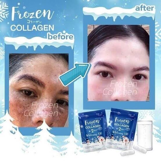 ❄️ Frozen Collagen 2 in 1 Whitening X10 – Daily Glow Formula (60 Capsules)authentic 100 💯