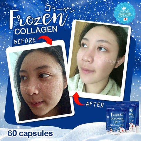 ❄️ Frozen Collagen 2 in 1 Whitening X10 – Daily Glow Formula (60 Capsules)authentic 100 💯