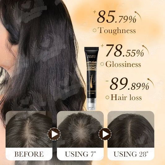 Zozu Anti hair loss regrowth essence