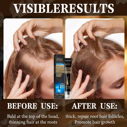 Zozu Anti hair loss regrowth essence