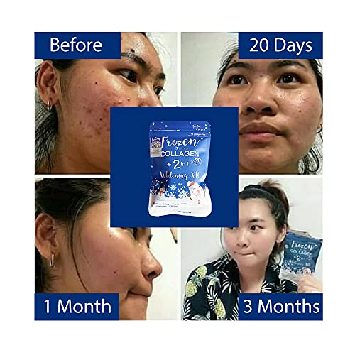 ❄️ Frozen Collagen 2 in 1 Whitening X10 – Daily Glow Formula (60 Capsules)authentic 100 💯