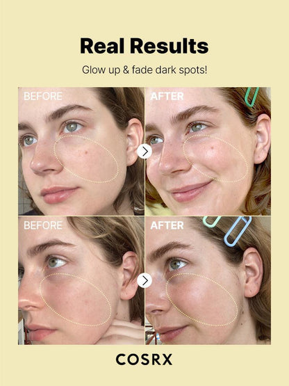 COSRX The Vitamin C 23 Serum 20gram