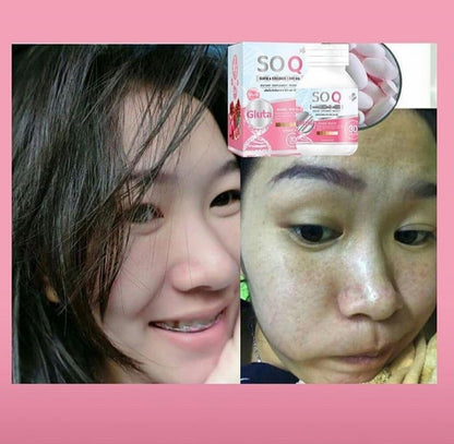 SOQ GLUTA & COLLAGEN 1,000 milligrams (food supplement, SOQ brand SN)