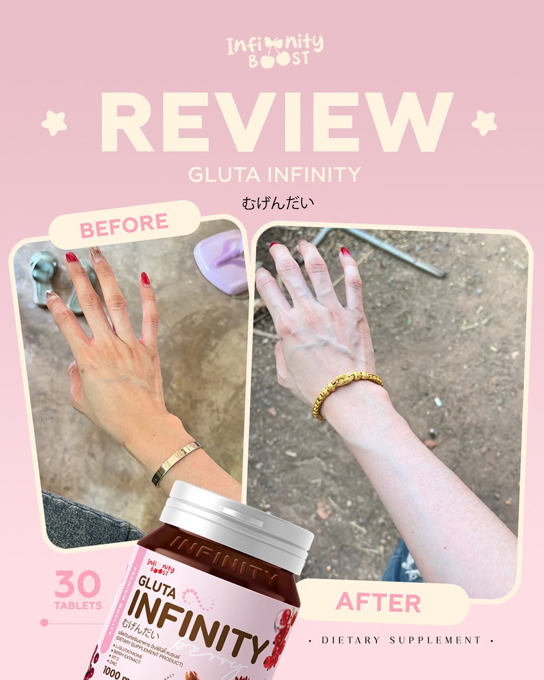 Gluta Infinity 1000mg Natural Whole Body Skin Whitening Supplement 30 Tablets